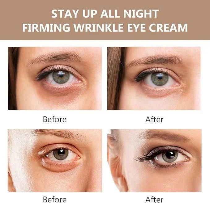 Instant FIRMx Eye Tightener & Eye Care Cream (Buy 1 Get 1 Freeš„)
