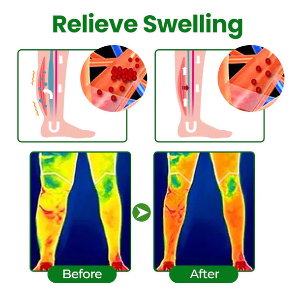 VeinFlex Magnesium Spray for Vein Relief 🔥 FDA Certified (Clinically proven relief for swollen legs, poor circulation, and varicose veins 🩺)