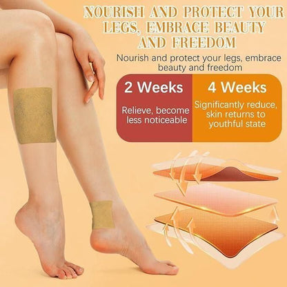 Spider & Varicose Vein Patches | Natural Herbal Therapy for Swelling, Fatigue & Vein Health (Buy 10 Get 10 Free)
