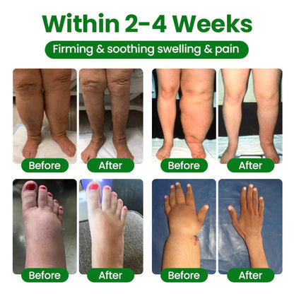 VeinFlex Magnesium Spray for Vein Relief 🔥 FDA Certified (Clinically proven relief for swollen legs, poor circulation, and varicose veins 🩺)