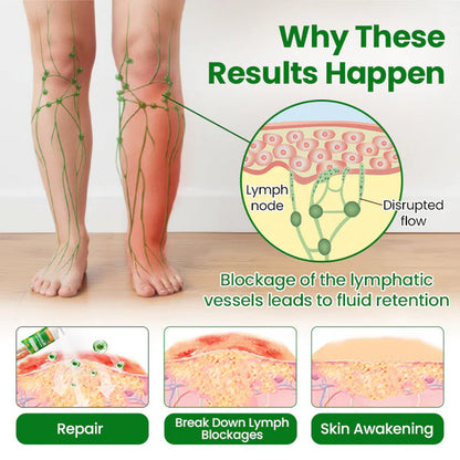 VeinFlex Magnesium Spray for Vein Relief 🔥 FDA Certified (Clinically proven relief for swollen legs, poor circulation, and varicose veins 🩺)