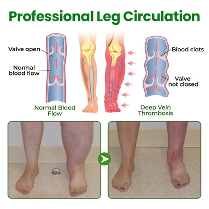 VeinFlex Magnesium Spray for Vein Relief 🔥 FDA Certified (Clinically proven relief for swollen legs, poor circulation, and varicose veins 🩺)