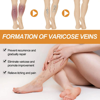 🌿 Varicose Vein Relief Spray – Soothing Comfort in Every Spray! 💧@549