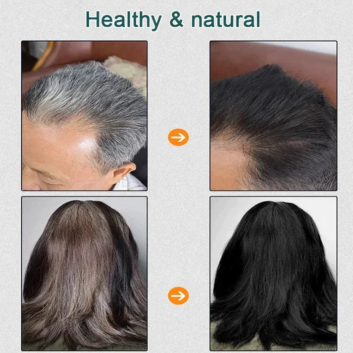 Natural Plant Hair Dye.Pouch BUY 1 GET 1 FREE 😍 ⭐⭐⭐⭐⭐ 74995+ Reviews