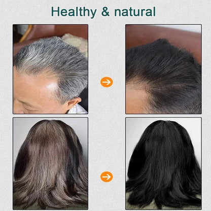 Natural Plant Hair Dye.Pouch BUY 1 GET 1 FREE 😍 ⭐⭐⭐⭐⭐ 74995+ Reviews