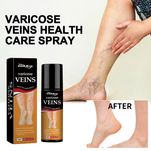 🌿 Varicose Vein Relief Spray – Soothing Comfort in Every Spray! 💧@549