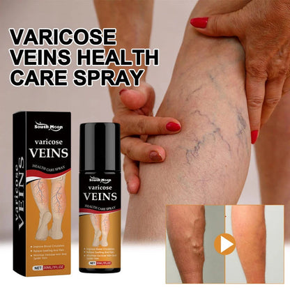 🌿 Varicose Vein Relief Spray – Soothing Comfort in Every Spray! 💧@549