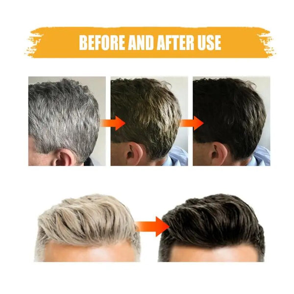 2-pack East Moon Black Soap Bar Shampoo