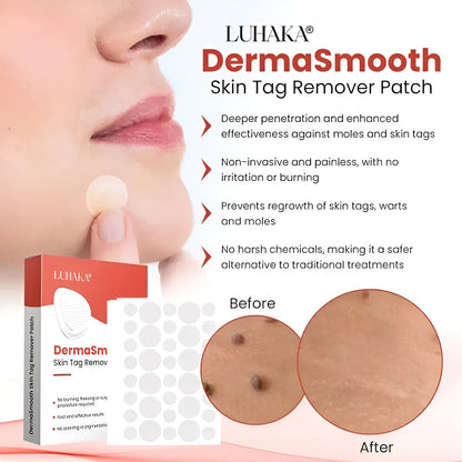 DermaSmooth - Skin Tags & Pimple Removal PATCH (Buy 36 Get 36 Free)