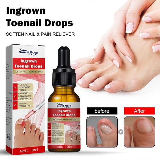SouthMoon Ingrown Toenail Drops Nail Fungal Repair( BUY 1 GET 1 FREE)
